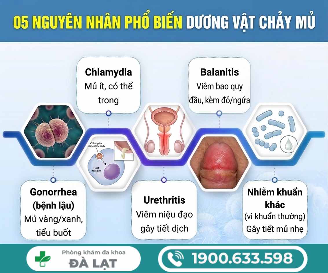 Hình ảnh minh họa